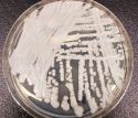 A strain of Candida auris cultured in a petri dish at a CDC laboratory.